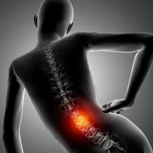 Rückenschmerzen und Schmerzen an der Wirbelsäule